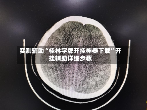 实测辅助“桂林字牌开挂神器下载”开挂辅助详细步骤-第2张图片