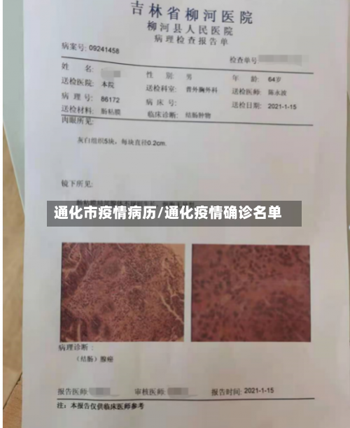 通化市疫情病历/通化疫情确诊名单-第2张图片