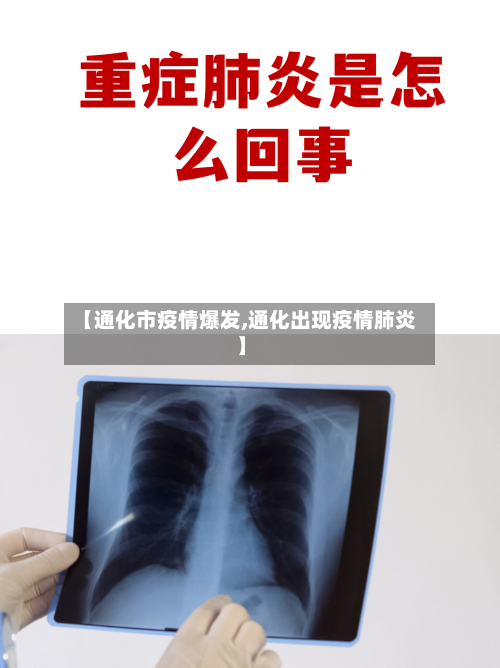 【通化市疫情爆发,通化出现疫情肺炎】-第2张图片
