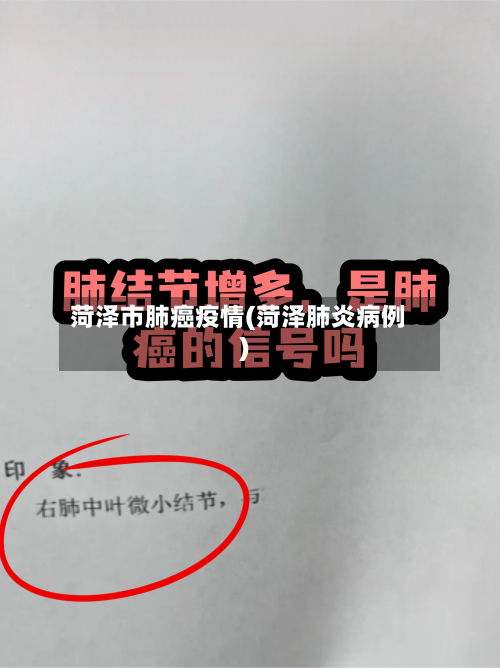 菏泽市肺癌疫情(菏泽肺炎病例)-第2张图片